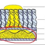 urine-in-pad