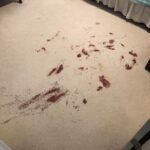 Blood Stain Removal From Carpet Before